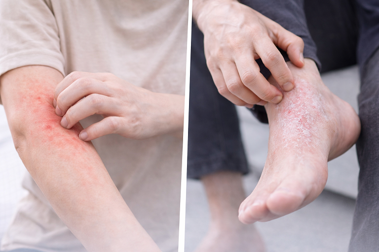 อาการตรงกับคนค้น (ไม่มีตัวหนังสือ/โลโก้ในภาพ)